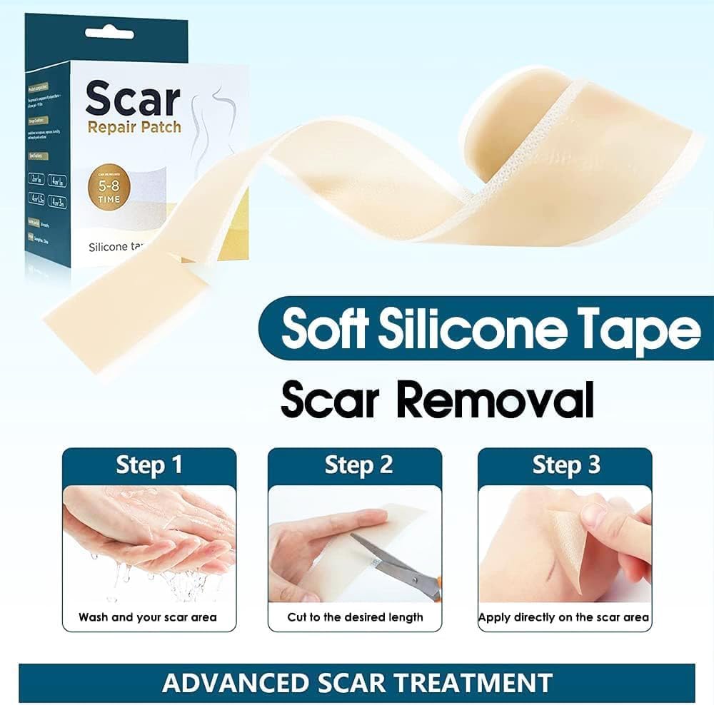 SKY-TOUCH Silicone Scar Sheets,Extra Long Scar Sheets for C-Section, Tummy Tuck, Keloid, and Surgical Scars - Reusable Medical Grade Silicone Scar Tape(4 x 150cm/1 Roll)