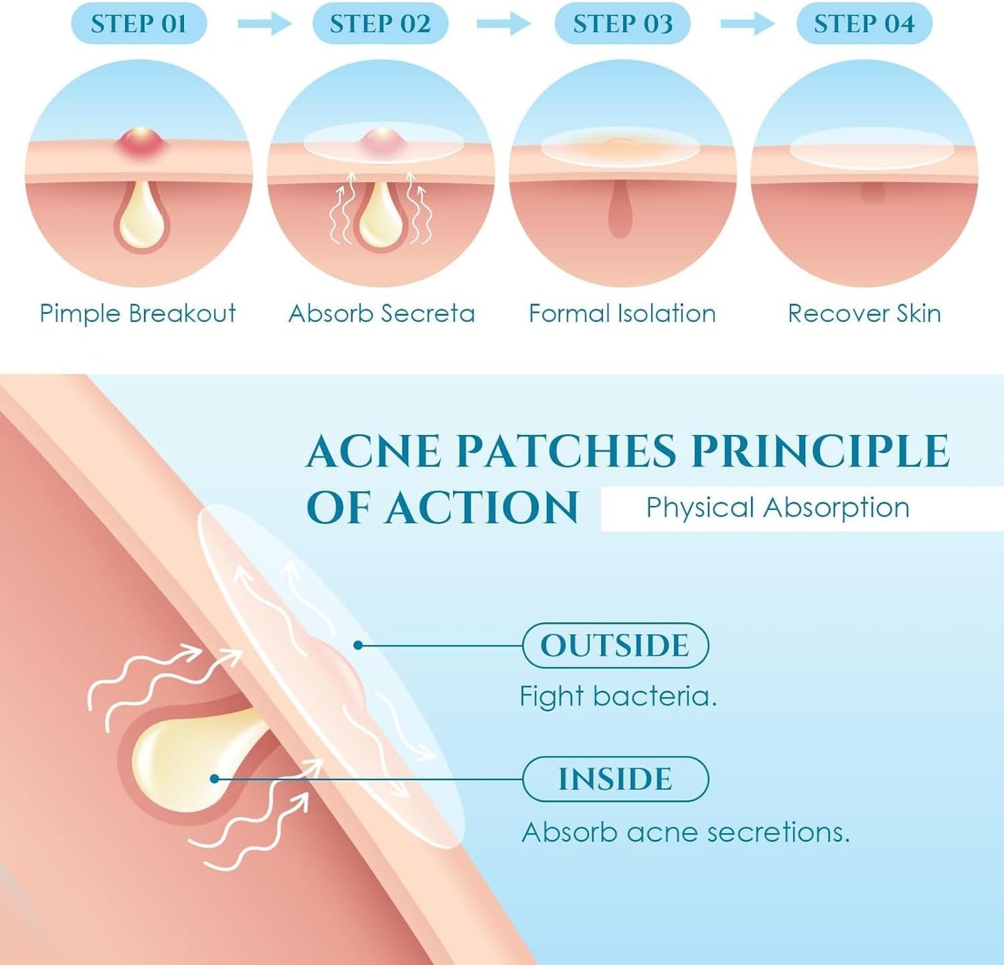 SKY-TOUCH Acne Pimple Patch,Invisible waterproof 1 Pack(36 Dots)