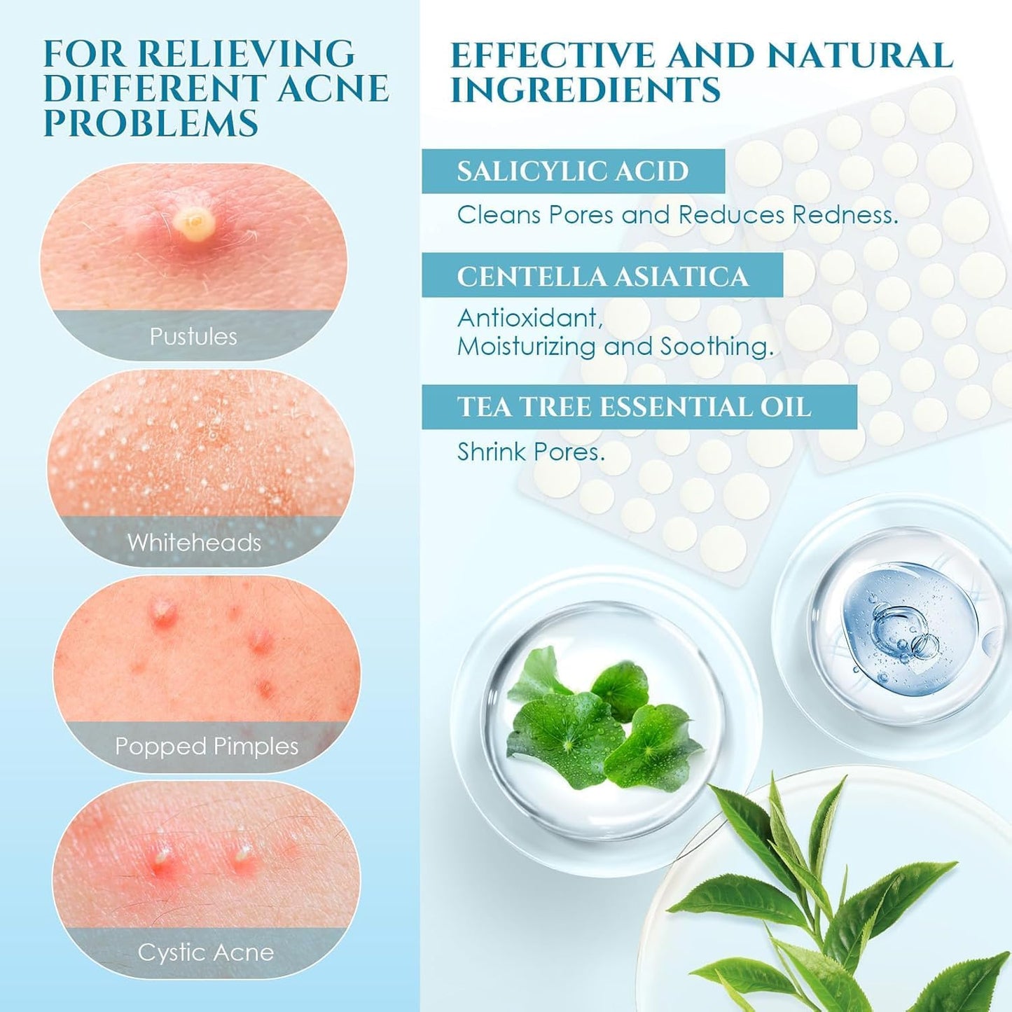 SKY-TOUCH Acne Pimple Patch,Invisible waterproof 1 Pack(36 Dots)