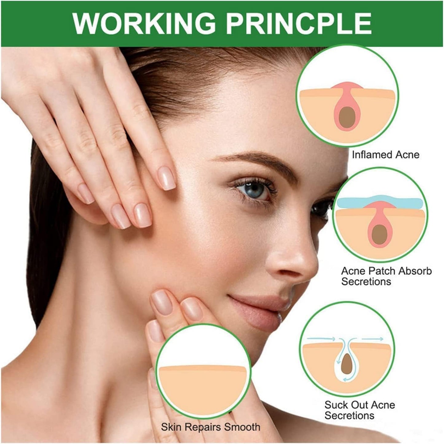 SKY-TOUCH Acne Pimple Patch,Invisible waterproof 1 Pack(36 Dots)