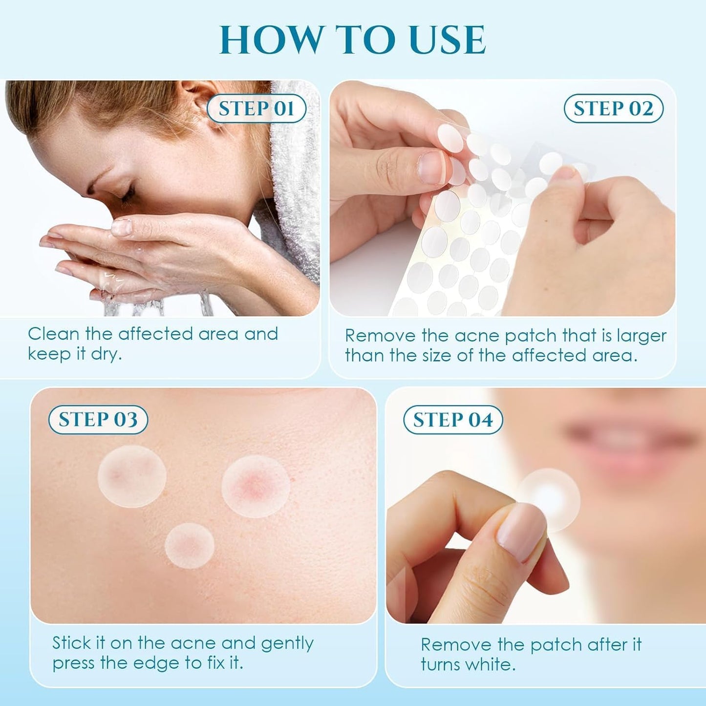 SKY-TOUCH Acne Pimple Patch,Invisible waterproof 1 Pack(36 Dots)