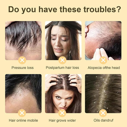 SKY-TOUCH Ginger Anti-Hair Loss Shampoo Set for Hair Growth and Hair Fall Control, Organic Anti Hair Loss Shampoo, Cleanse Moisturize Hair and Keep Scalp Health, 380ml + 5ml x 12 Bottle for Men Women