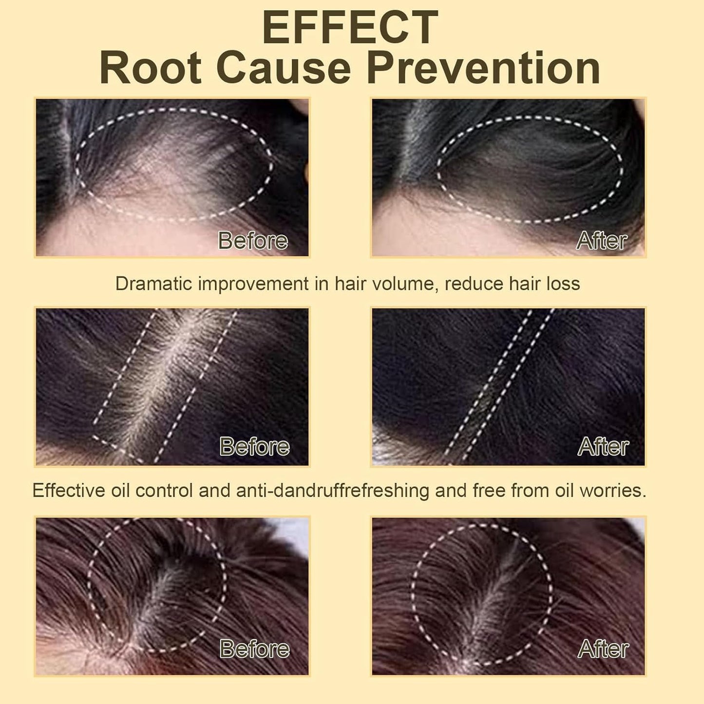 SKY-TOUCH Ginger Anti-Hair Loss Shampoo Set for Hair Growth and Hair Fall Control, Organic Anti Hair Loss Shampoo, Cleanse Moisturize Hair and Keep Scalp Health, 380ml + 5ml x 12 Bottle for Men Women