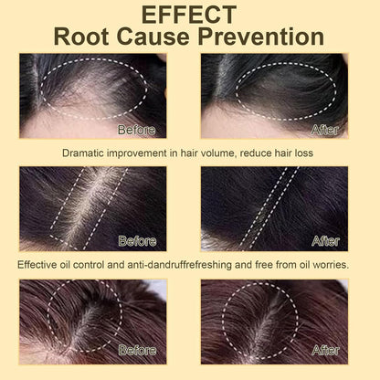 SKY-TOUCH Ginger Anti-Hair Loss Shampoo Set for Hair Growth and Hair Fall Control, Organic Anti Hair Loss Shampoo, Cleanse Moisturize Hair and Keep Scalp Health, 380ml + 5ml x 12 Bottle for Men Women