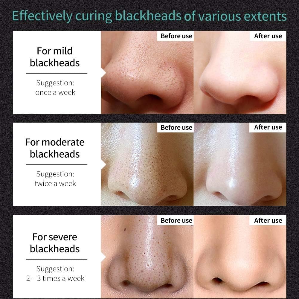 SKY-TOUCH Blackhead Removal Mask Peel Off Facial Black Mask, Purifying Bamboo Charcoal Nose Facial, Removes Blackheads Acne, Deep Pore Cleansing, Skin Brightening for All Skin Types of Men and Women