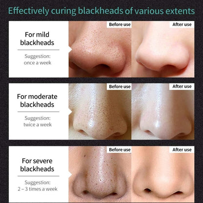SKY-TOUCH Blackhead Removal Mask Peel Off Facial Black Mask, Purifying Bamboo Charcoal Nose Facial, Removes Blackheads Acne, Deep Pore Cleansing, Skin Brightening for All Skin Types of Men and Women