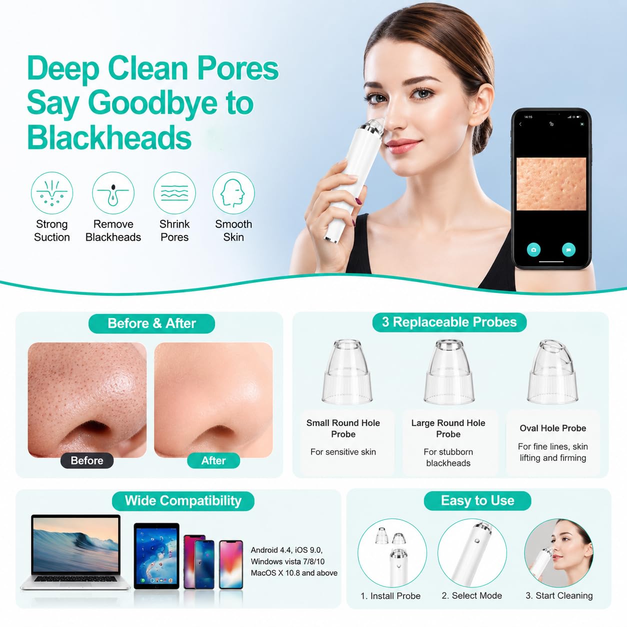 SKY-TOUCH Blackhead Remover Pore Vacuum with HD Camera, WiFi Visible Facial Pore Cleanser, Electric Blackhead Suction Tool with 6 Suction Heads & 3 Modes, USB Rechargeable
