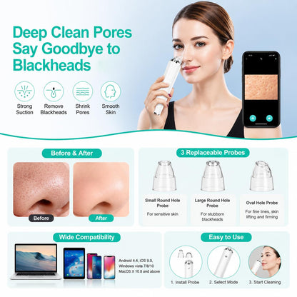 SKY-TOUCH Blackhead Remover Pore Vacuum with HD Camera, WiFi Visible Facial Pore Cleanser, Electric Blackhead Suction Tool with 6 Suction Heads & 3 Modes, USB Rechargeable