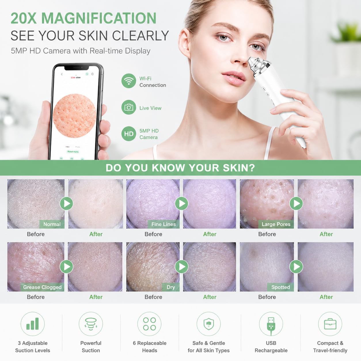 SKY-TOUCH Blackhead Remover Pore Vacuum with HD Camera, WiFi Visible Facial Pore Cleanser, Electric Blackhead Suction Tool with 6 Suction Heads & 3 Modes, USB Rechargeable