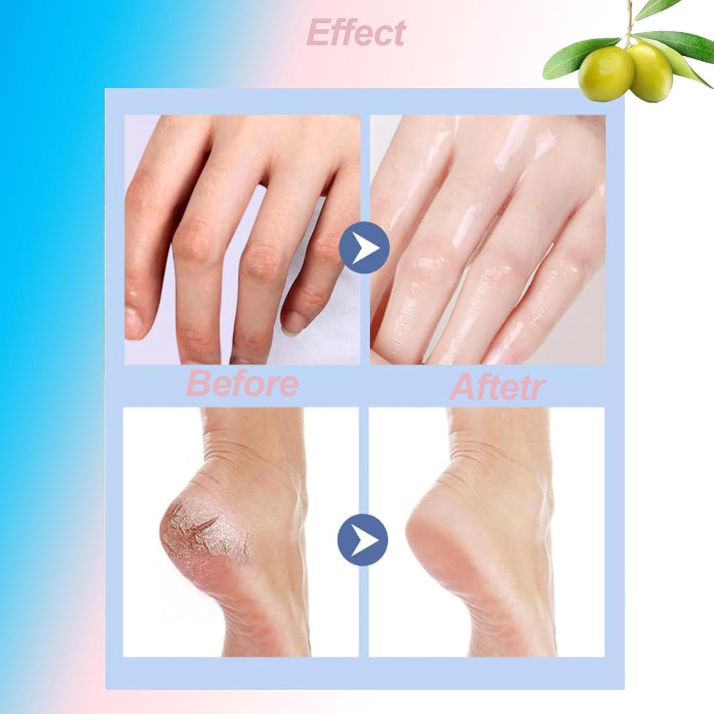 SKY-TOUCH Foot & Hand Repair Stick – Moisturizing Balm for Dry, Cracked Skin, Enriched with Vitamin E & Squalane, 40g, Protective Barrier for Soft, Smooth Skin