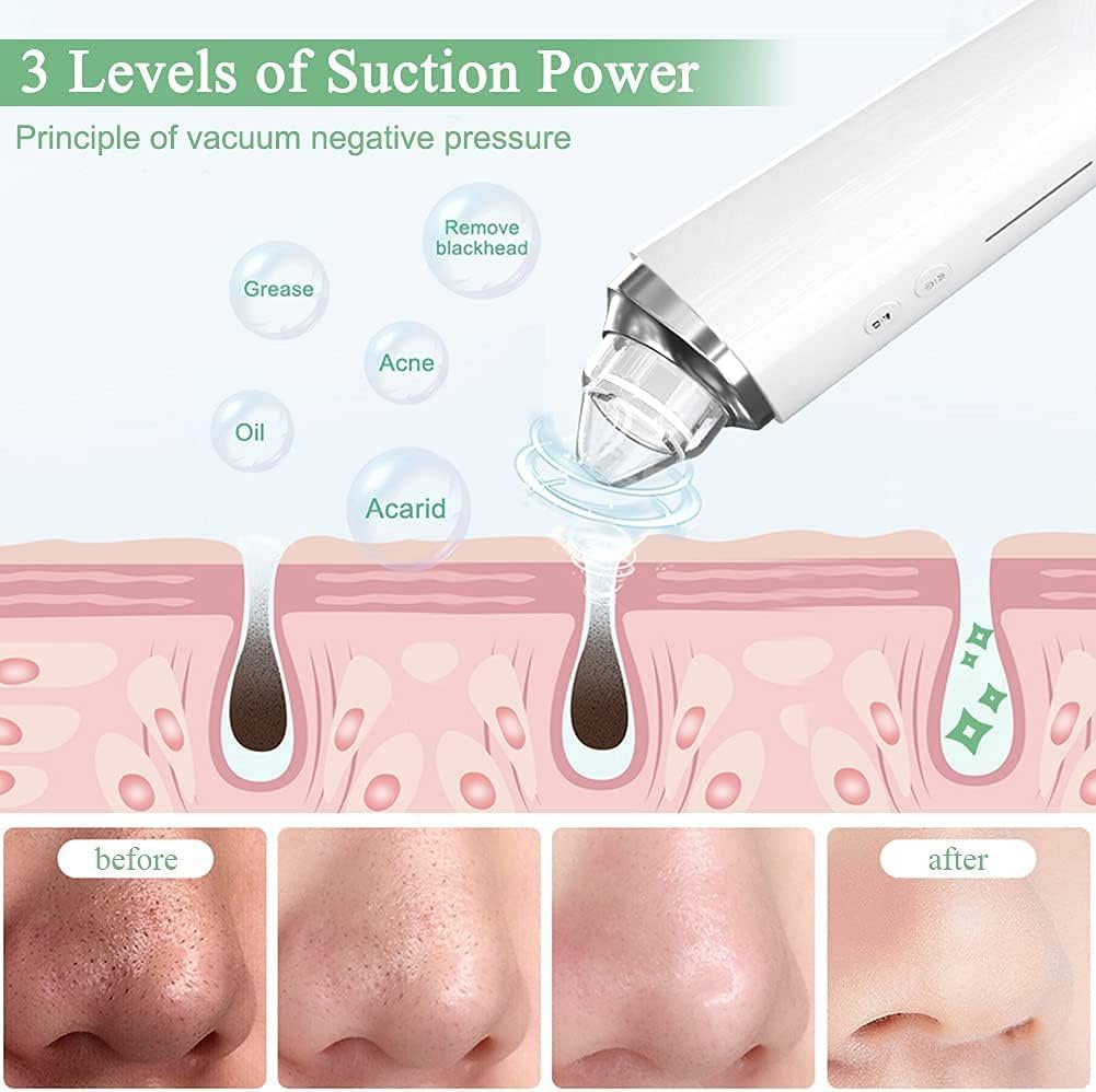 SKY-TOUCH Blackhead Remover Pore Vacuum with HD Camera, WiFi Visible Facial Pore Cleanser, Electric Blackhead Suction Tool with 6 Suction Heads & 3 Modes, USB Rechargeable