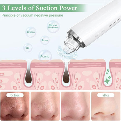 SKY-TOUCH Blackhead Remover Pore Vacuum with HD Camera, WiFi Visible Facial Pore Cleanser, Electric Blackhead Suction Tool with 6 Suction Heads & 3 Modes, USB Rechargeable