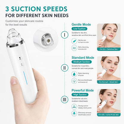 SKY-TOUCH Blackhead Remover Pore Vacuum with HD Camera, WiFi Visible Facial Pore Cleanser, Electric Blackhead Suction Tool with 6 Suction Heads & 3 Modes, USB Rechargeable